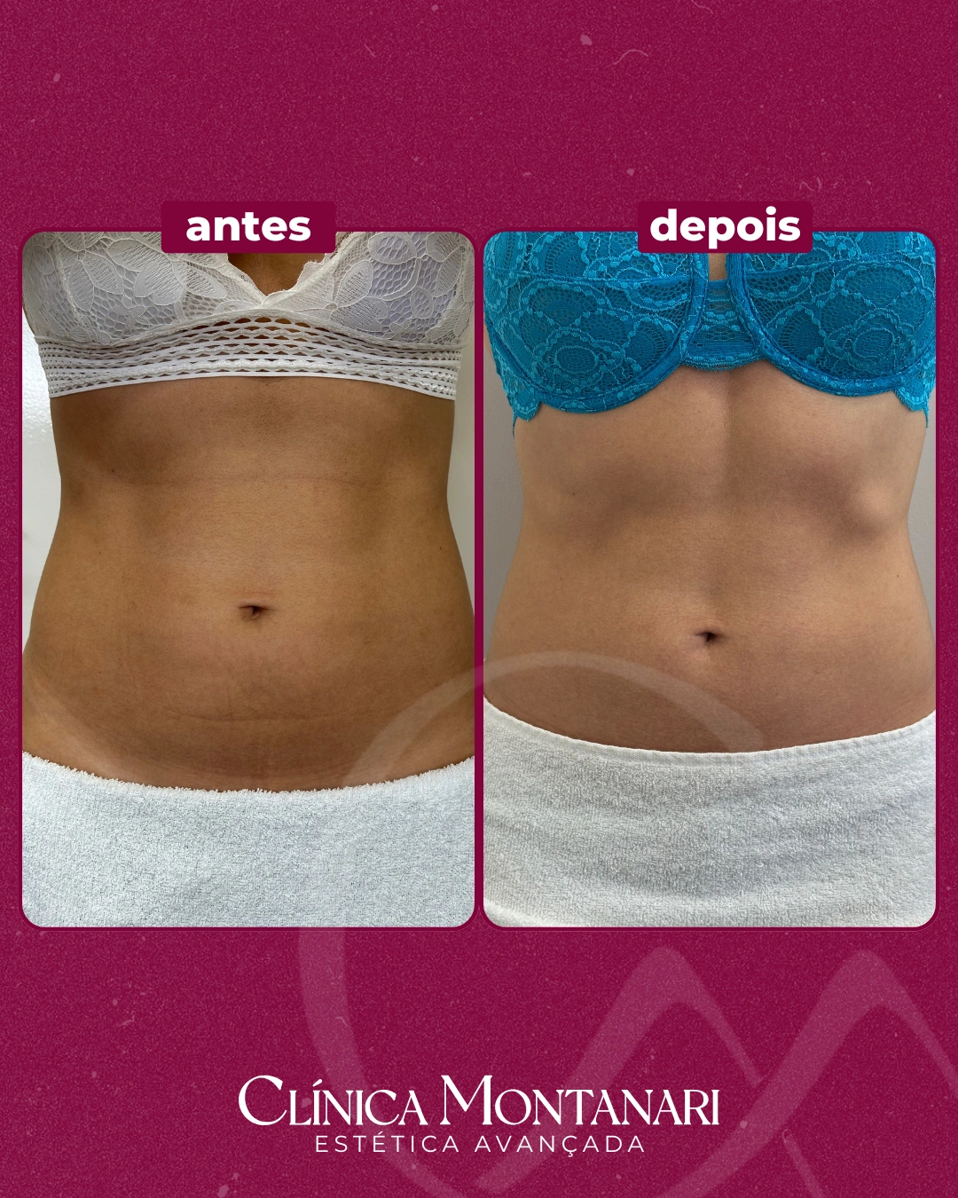 Resultado Clínica Montanari