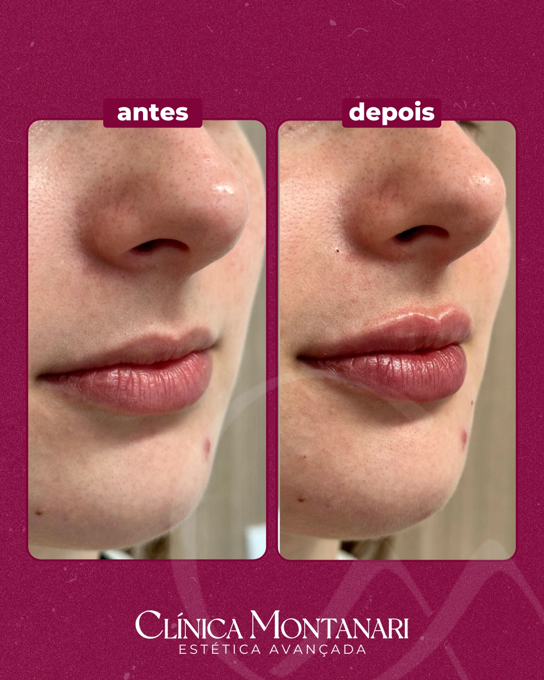 Resultado Clínica Montanari