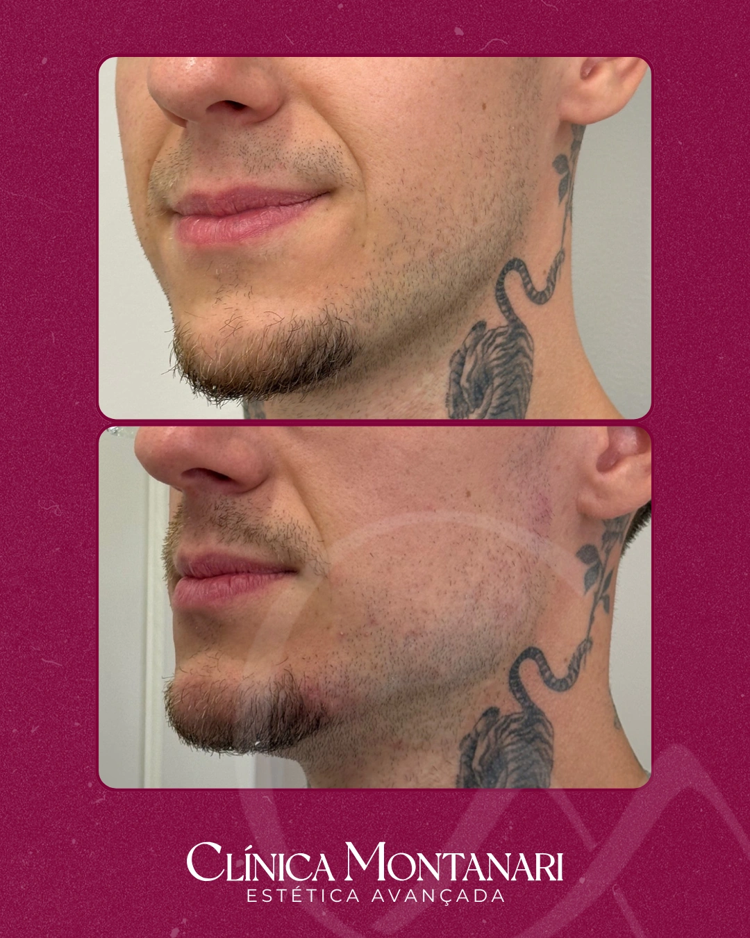 Resultado Clínica Montanari