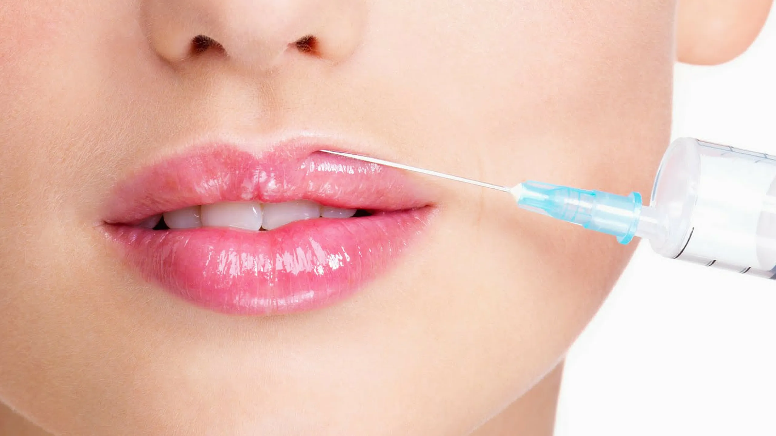 Aplicação de Preenchimento com Ácido Hialurônico